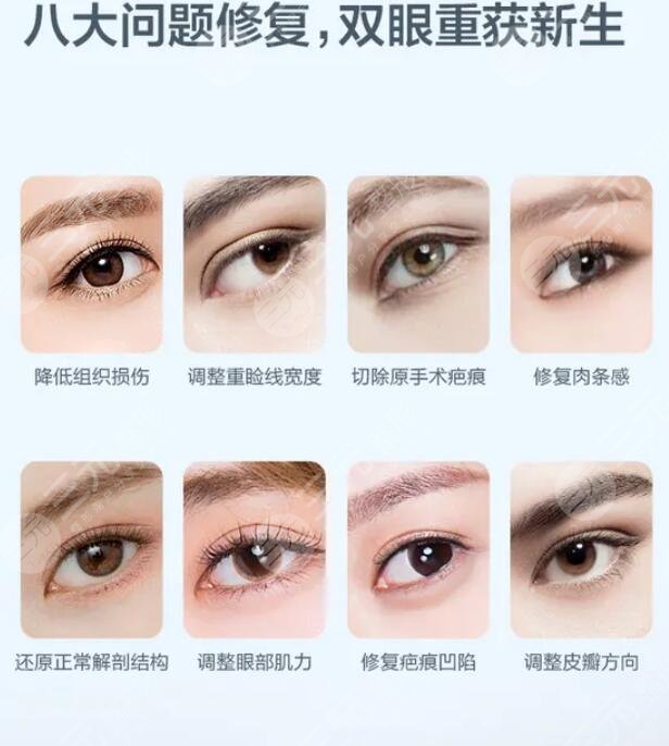 手术方法的修复难度