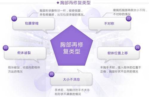 隆胸修复