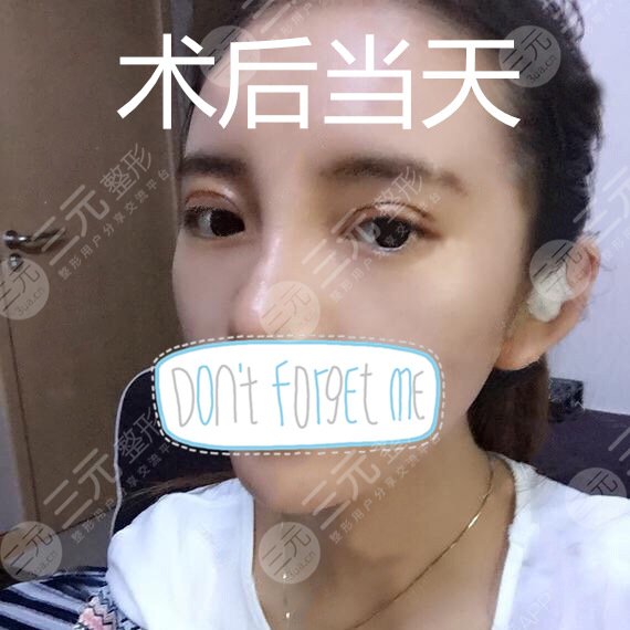 长沙贝美整形医院好吗