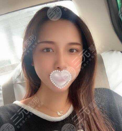武汉德美热玛吉做得好不好