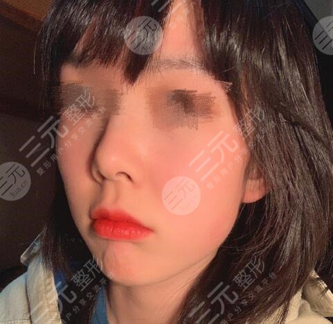 南京明基医院美容科怎么样