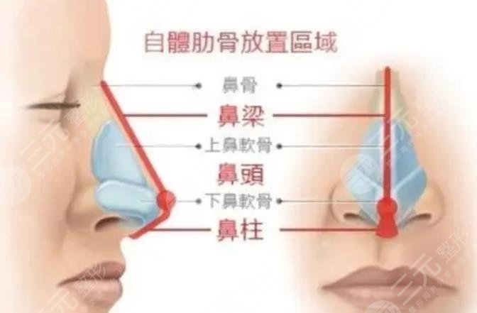 肋骨鼻相关知识科普