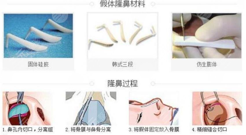 鼻部手术整形概念