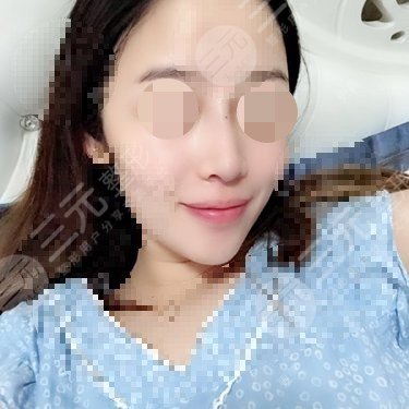 天使之翼做鼻子怎么样