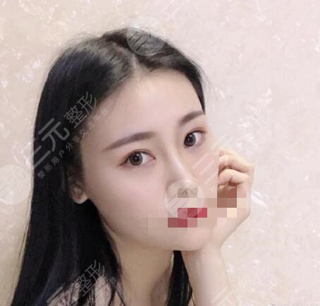 修志夫做鼻子怎么样