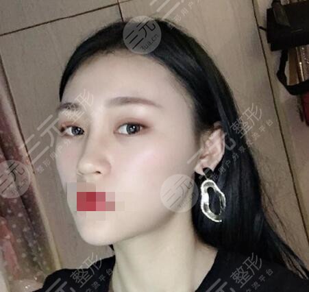 修志夫做鼻子怎么样