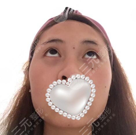 广州紫馨医院整形价格表