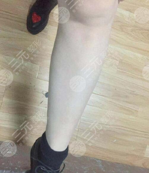 深圳瑞尼丝国际脱毛中心