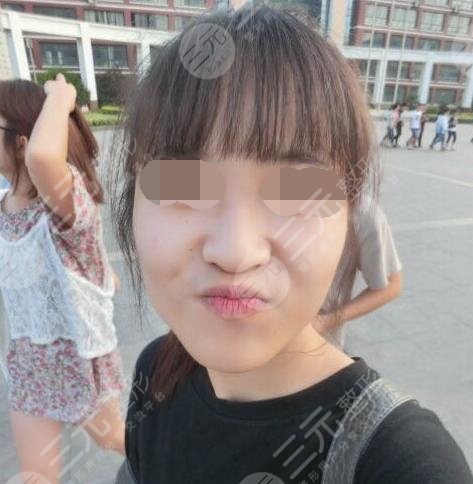 内蒙古附院有医美吗