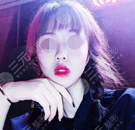 内蒙古附院有医美吗