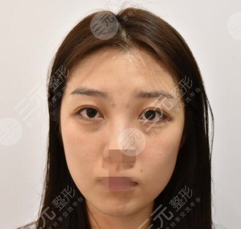 上海翔茂整形医生