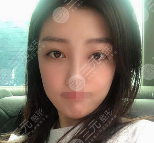 上海翔茂整形医生
