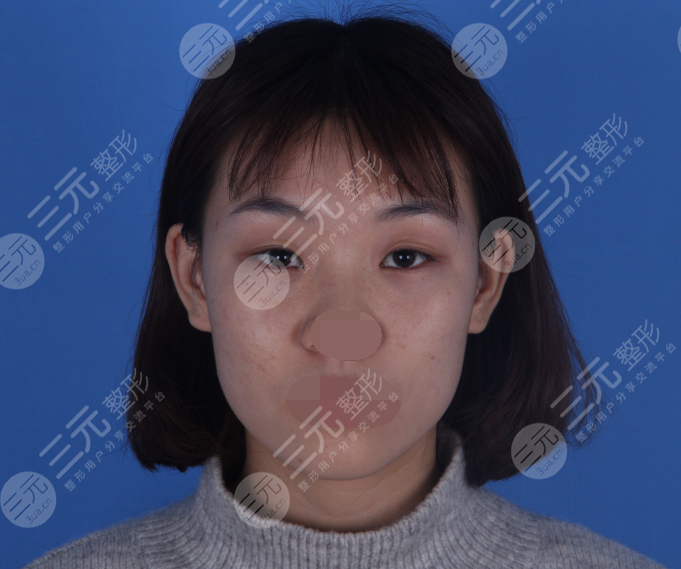 上海al国际整形医院怎么样