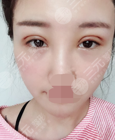 广州禾丽医美是正规医院吗