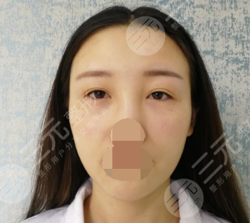 广州禾丽医美是正规医院吗