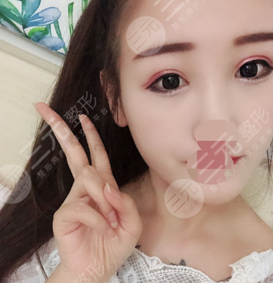 广州禾丽医美是正规医院吗