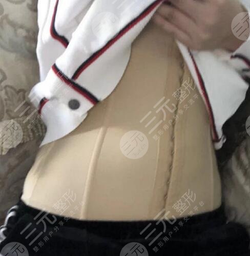 上海ido整形怎么样