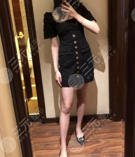 上海ido整形怎么样