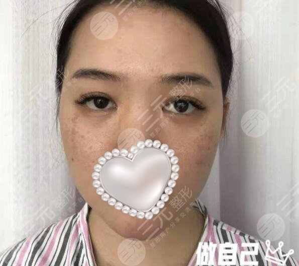 广州宸山医疗美容门诊怎么样