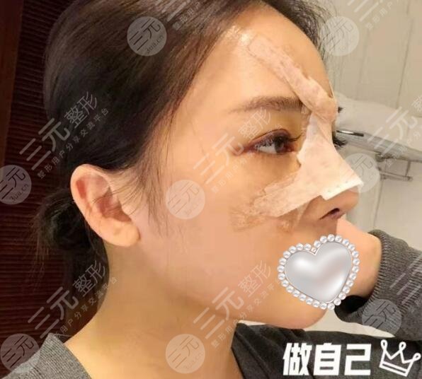 广州宸山医疗美容门诊怎么样