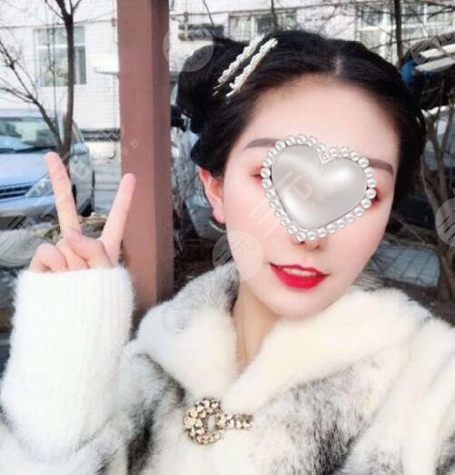 北京雅朴丽德面部抗衰案例