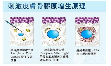 种植面膜的价格