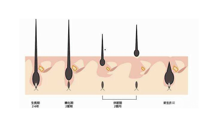 5000块可以植发吗