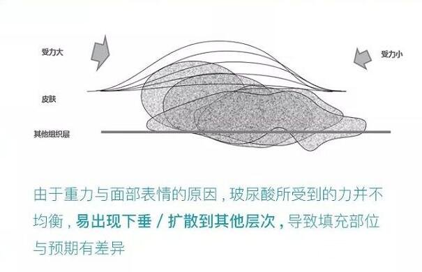 均质的颗粒，带来的获益是什么?