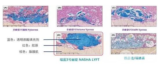 自然程度(与组织是否融合度高)