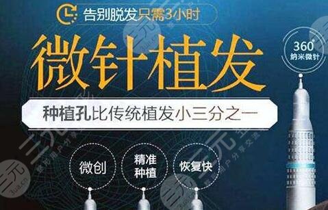 果好的微针植发适用于哪些人?