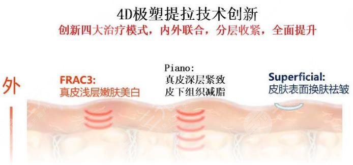 欧洲之星