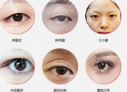 整形还能改变运势？开运整形项目了解一下