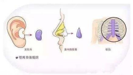 自体材料