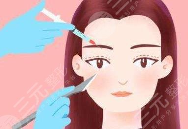 双眼皮