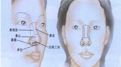 八大处整形医院隆鼻术后反馈
