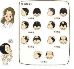北医三院植发医生名单