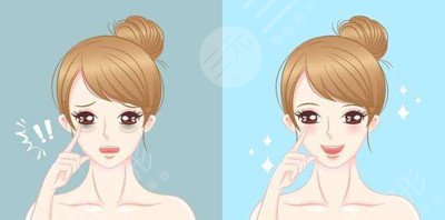 激光美肤案例