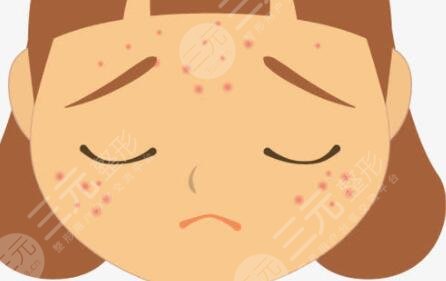 湘雅医院皮肤激光祛斑果图