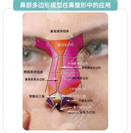 假体隆鼻