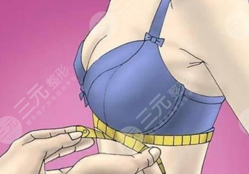杨庆华隆胸项目科普
