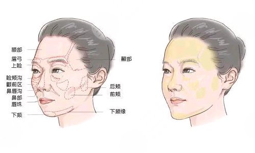 广州华美医疗美容医院开设项目