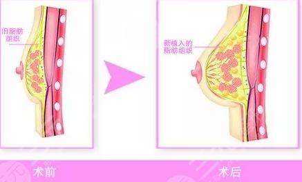 广州华美医疗美容医院开设项目