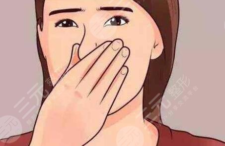 广州禾丽整形医院隆鼻案例术前