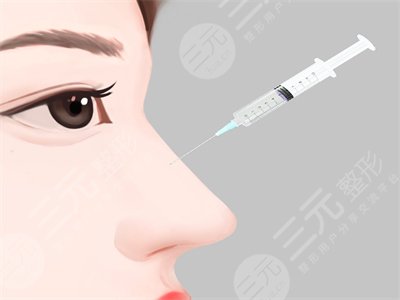 欧美瑞医疗美容医院玻尿酸隆鼻案例