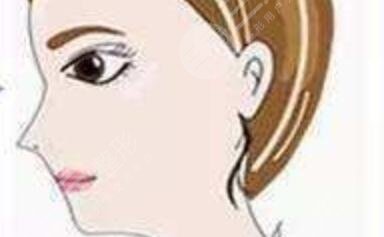 哈尔滨211医院美容科隆鼻案例