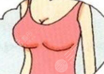 青大附院医学美容中心怎么样?医疗团队信息丨胸部下垂矫正案例~