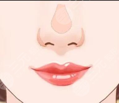 北京丽港整形美容怎么样?坐诊医生列表/玻尿酸隆鼻案例~