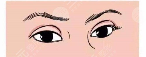 小榄人民医院整形美容怎么样？附双眼皮真实案例~