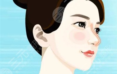 郑大一附院隆鼻怎么样 附上隆鼻案例~