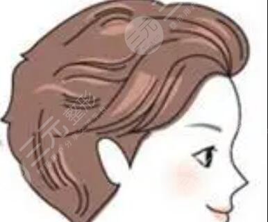 成都首瑞植发价格表|发际线种植真实案例果图分享